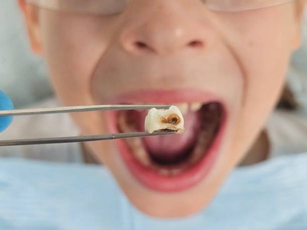 Best Walk-In Emergency Dentist in St George, SC